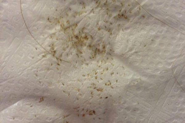 what do nits look like on paper towel